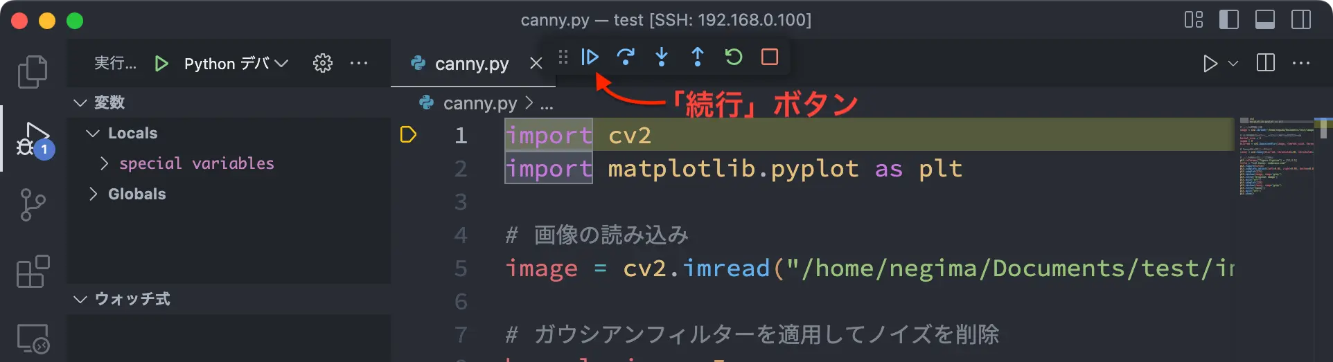 VS Code 続行ボタン